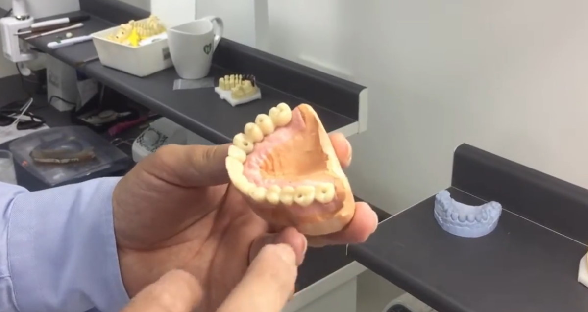 3 techniques pour refaire toutes ses dents en une seule fois — free download